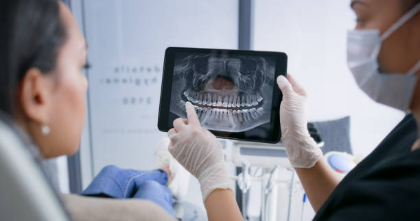 Licensed Teeth Whitening service in Spartanburg, SC - Smile Center Dentistry